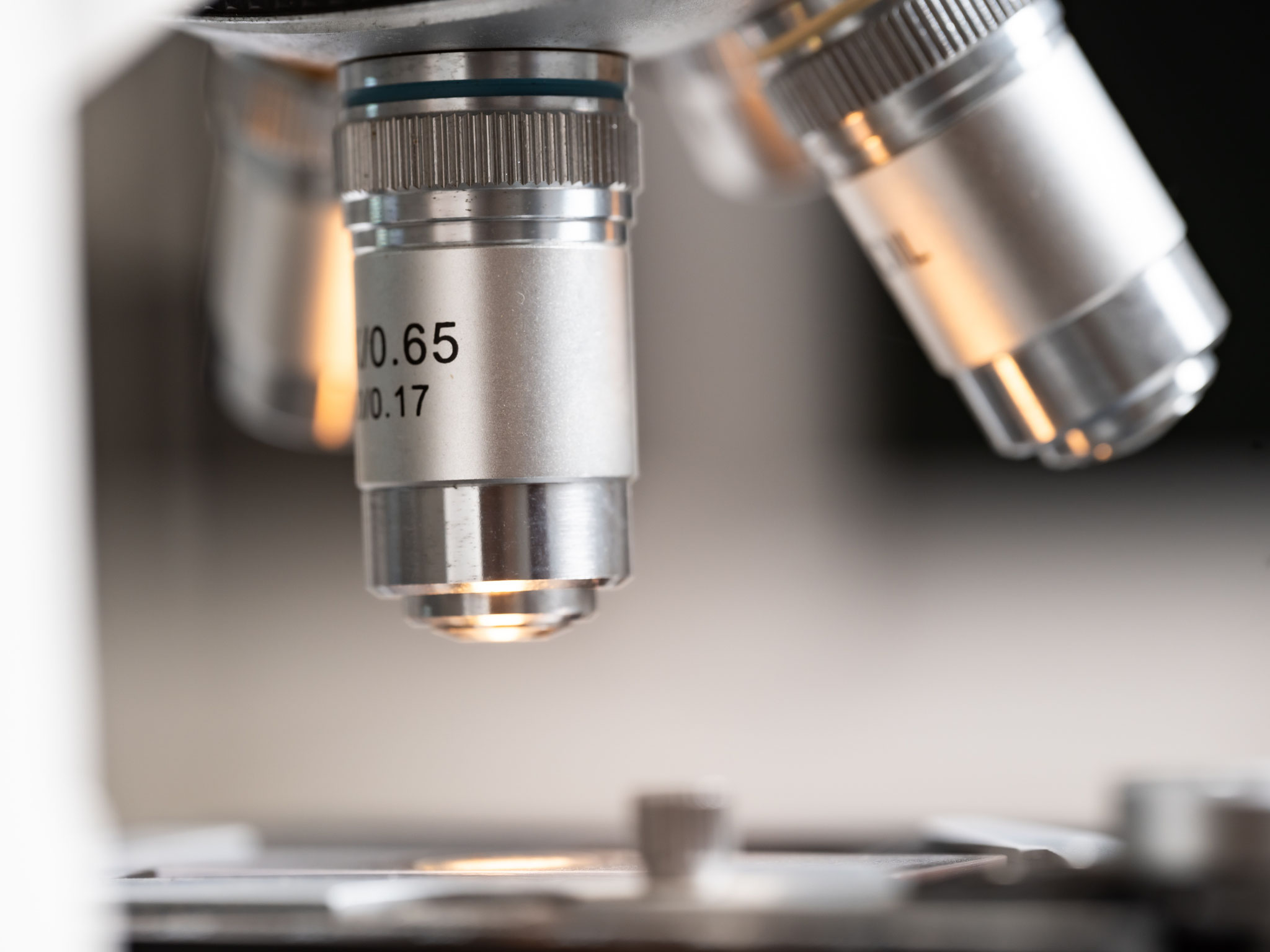 Mikrobiologische Laboruntersuchungen