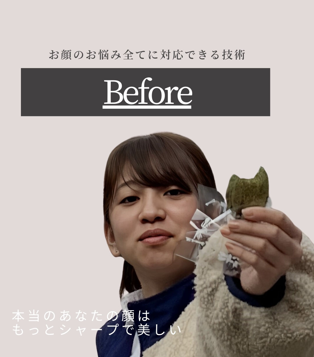 徳島のあおぞら整体院の小顔整体の前の状態で、フェイスラインが広がり、表情筋の緊張が見られる施術前写真。