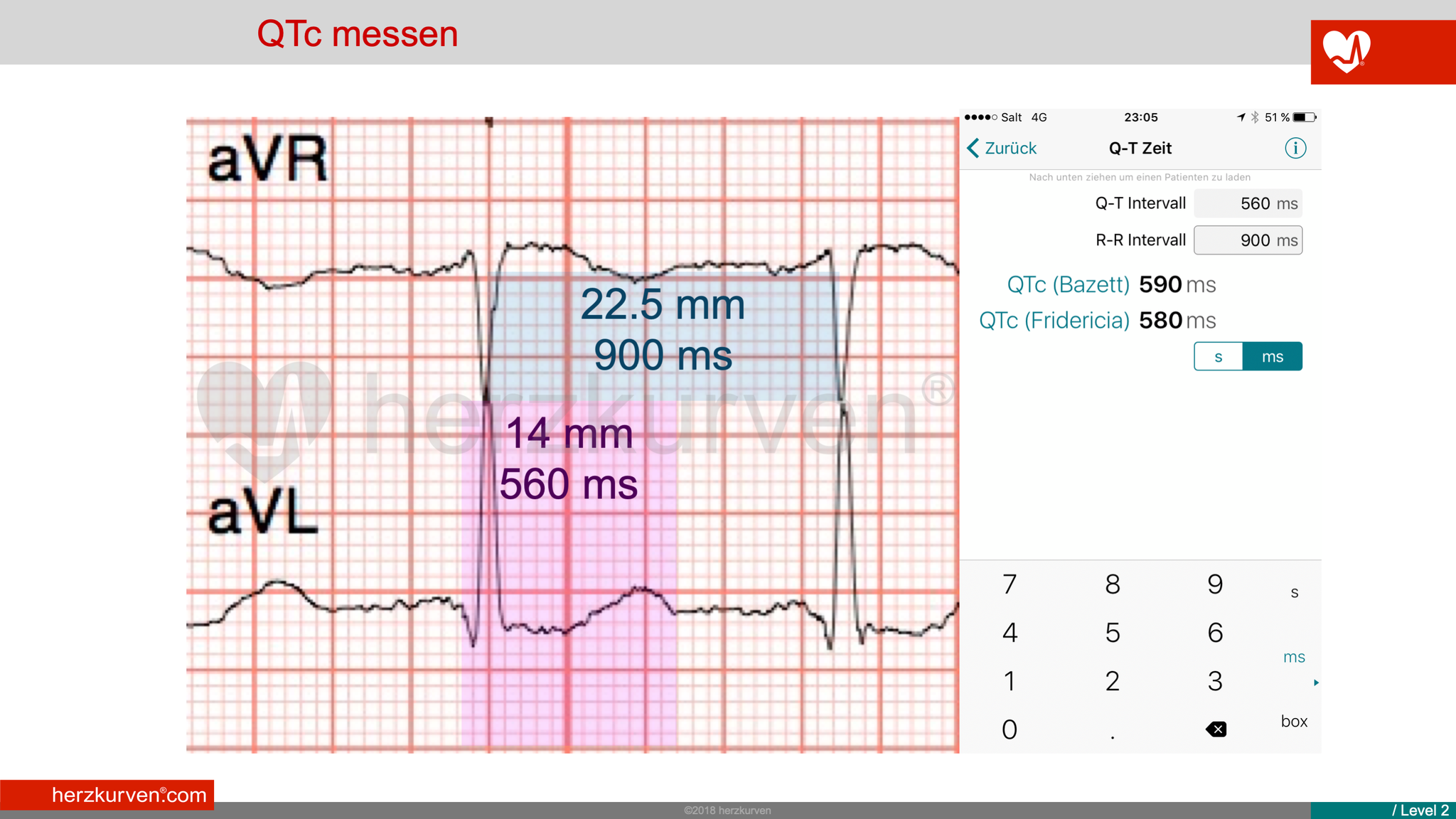 QT-Zeit? - herzkurven