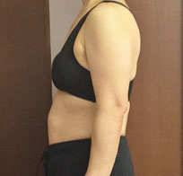 DNAパーソナル痩身、モニターさん