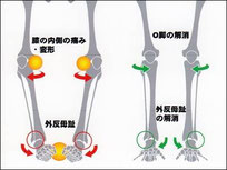 Ｏ脚の直し方ウォーキング