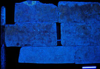 Untersuchung mit UV