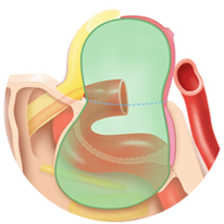 Schaubild Hypophysenadenom