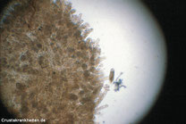 Epistylis 100 fach vergrößert. Foto: Dr. Gerald Bassleer.