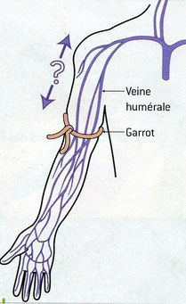LeDeux possibilités de circulation du sang dans le bras. Source: SVT, Nathan, 2006.