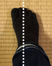 外反母趾の方はこのような歩き方(内股歩き)になりやすいです