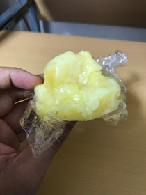 小牧 腰痛 自律神経 鍼灸 差し入れ
