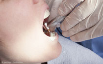 Zahnärzte empfehlen zwei professionelle Zahnreinigungen während der Schwangerschaft. (© patrisyu - Fotolia.com)