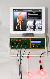Softlaser Octopus 2110 Quattro mit Display für Triggerpunktdarstellung