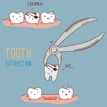 Emergency Dental Extraction