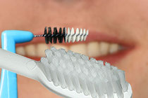 Le brossage des dents - © Copyright ParoSphère 