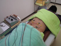 電気はり はりパルス治療 鎮痛作用 急性痛