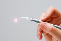 Weichgewebe-Laser für Zahnfleischbehandlungen (© LosRobsos - Fotolia.com)