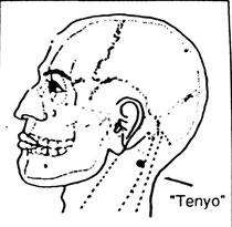 Tonsil point (Tenyo)