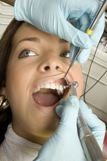 Professionelle Zahnreinigung Weiden (PZR)