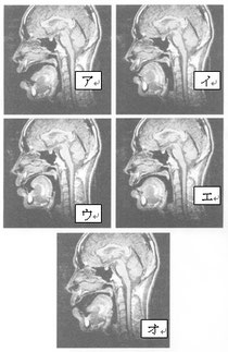 図５　母音発声時のＭＲＩ画像