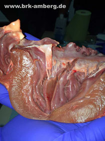 Das aufgeschnitten Herz mit den filigranen anatomischen Strukturen