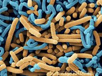 Grâce aux PROBIOTIC PRO12 de LR vous avez douze souches de bactéries différentes. Probiotiques PRO12 vers une santé plus solide - Aloe Vera Santé Beauté - LR Health and Beauty