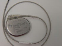Herzschrittmacher mit Elektrode