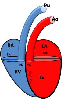 RA: rechtes Atrium; RV: rechter Ventrikel; PK: Pulmonalklappe; Pu: Pulmonalarterie; LA: linkes Atrium; LV: linker Ventrikel; MK: Mitralklappe; Ao: Aorta
