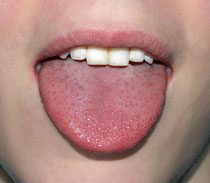 Auf dem Zungenrücken bildet sich oft Belag (© Amanda Day)