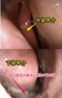 2枚を合成しています