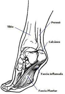 fascia plantar