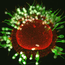 Oocyte in Focus - Courtesy by Dr. Felix A. Habermann