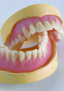 Zahnprothese in Wachs