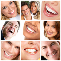 Mit Veneers bleiben Zähne dauerhaft schön und weiß. (© Kurhan - Fotolia.com)