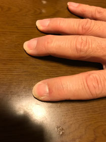 人差し指だけ爪が短い。わかるかな?