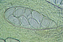 Sporenschlauch des Winzigen Kotlings (Ascobolus immersus).