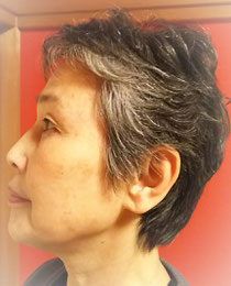 グレイヘア移行中のTさん