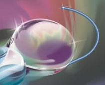 Product of DISTRA-GROUP AG, Switzerland