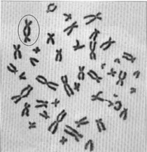 Dicentrie d'un chromosome