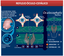 Reflejo oculocefalico, Neurologia, simulador medico