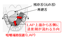 図4 LAP上の食塊の流れ