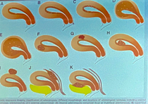 Adenomyose Mic Rhein Main