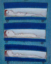 SOLARIUM II, Acryl  100X80 cm 1.900,-€