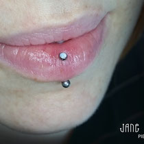 Vertical Labret Piercing aka Eskimo mit dem Schmuck von der Firma "NeoMetal". Stärke: 1,2mm, Größe von dem Aufsatz: 2,5mm.