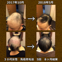 辻式脱毛症研究所 - カラダの内側から髪を元気にするラボ 辻式脱毛症研究所 - カラダの内側から髪を元気にするラボ