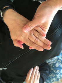 片麻痺の施術