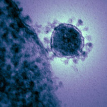 The electron microscope generates this image of the corona virus.