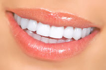 Weiße Zähne mit Bleaching (Zahnaufhellung) (© Kurhan - Fotolia.com)