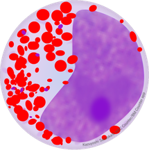 好酸球性後骨髄球 Eosinophilic metamyelocyte