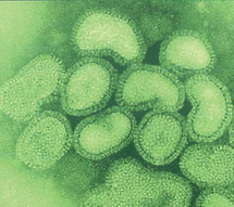 　　　　　電子顕微鏡で見るインフルエンザ菌