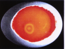 Abb 2.: Embryo 12 Stunden nach der Befruchtung