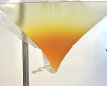 INUSpherese® – Sanfte Blutreinigung. Das Eluat zeigt ein unauffälliges Bild. Es ist ein "Normalbefund".