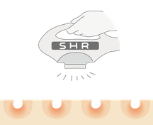 SHR脱毛イメージ図_02
