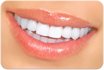 Weiße Zähne mit Bleaching (Zahnaufhellung) (© Kurhan - Fotolia.com)